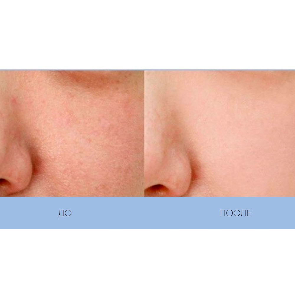 Увлажняющий крем для лица с муцином улитки Beaute Melasma X Snail Moisture Cica Cream 100 мл